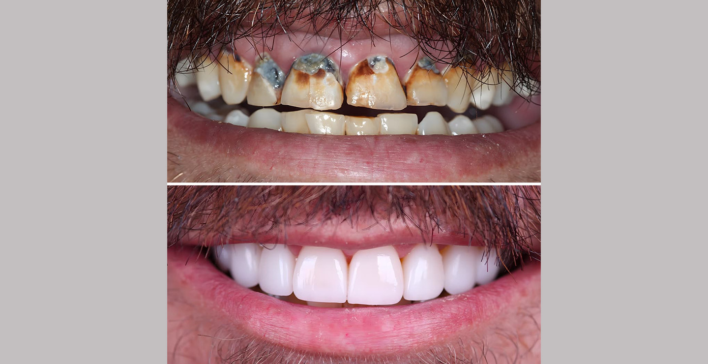 Plastic Surgery Result 3