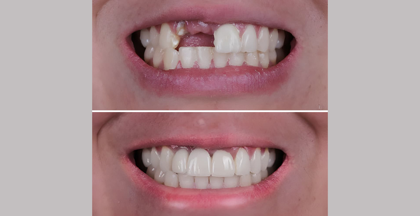 Plastic Surgery Result 4